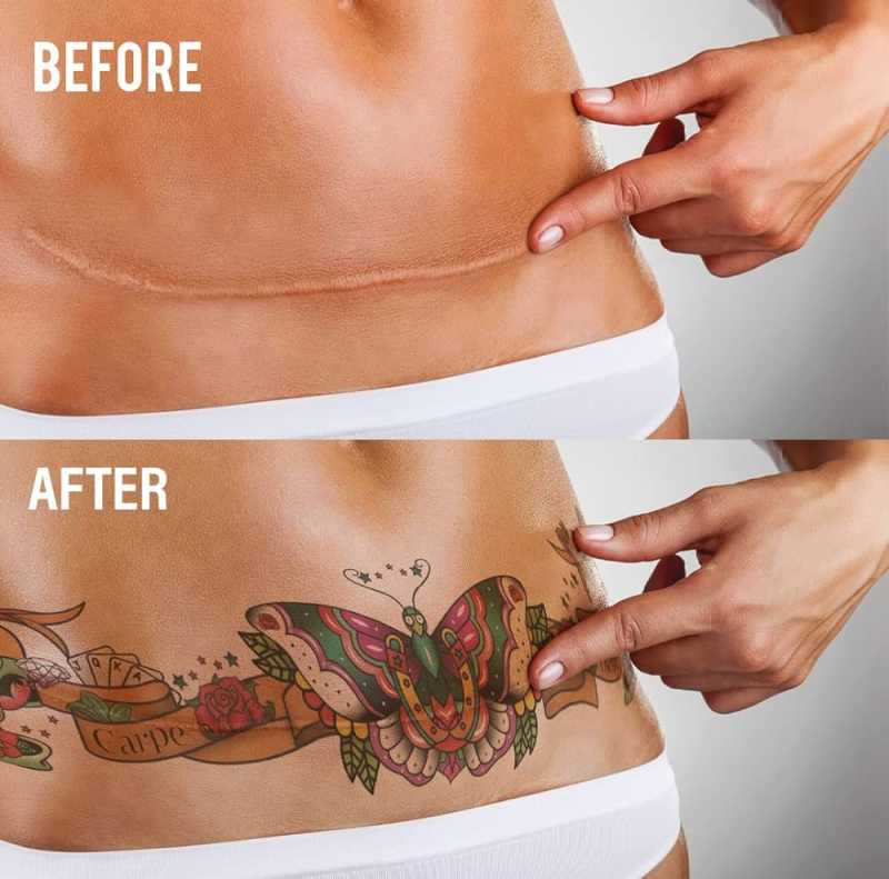 Carpe Diem Temporary Tattoo - Tummy Tuck/Mastectomy Scar Cover, Realistic  and Long Lasting, Fashionable and Safe