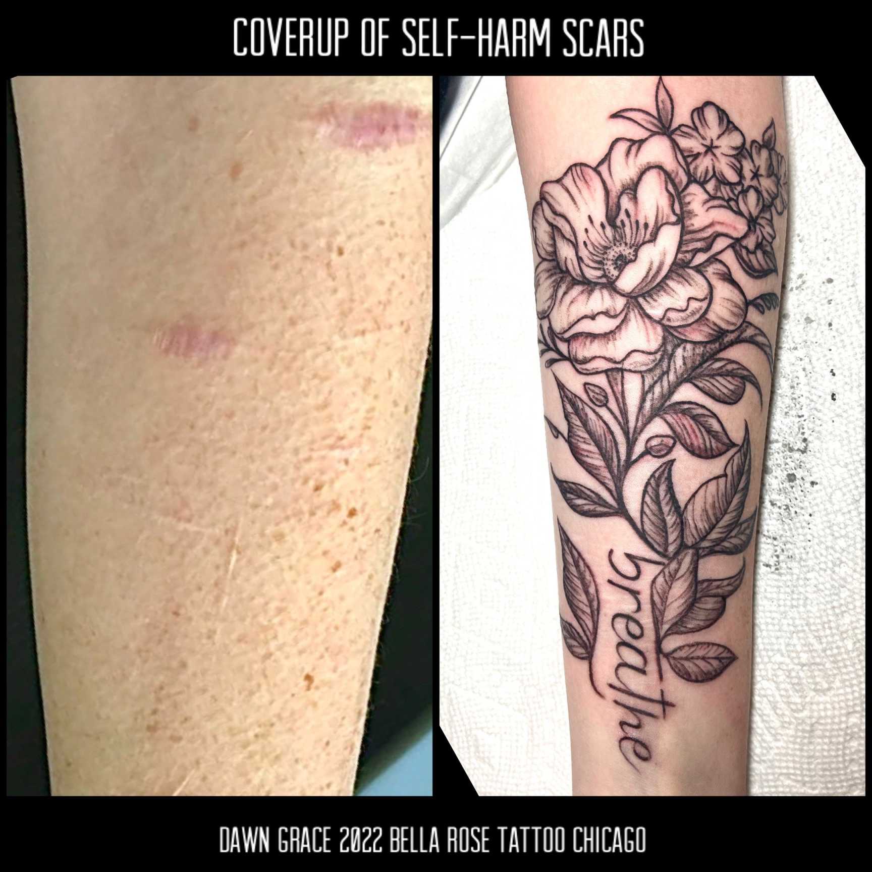 self-harm scar coverups — bella rose tattoo
