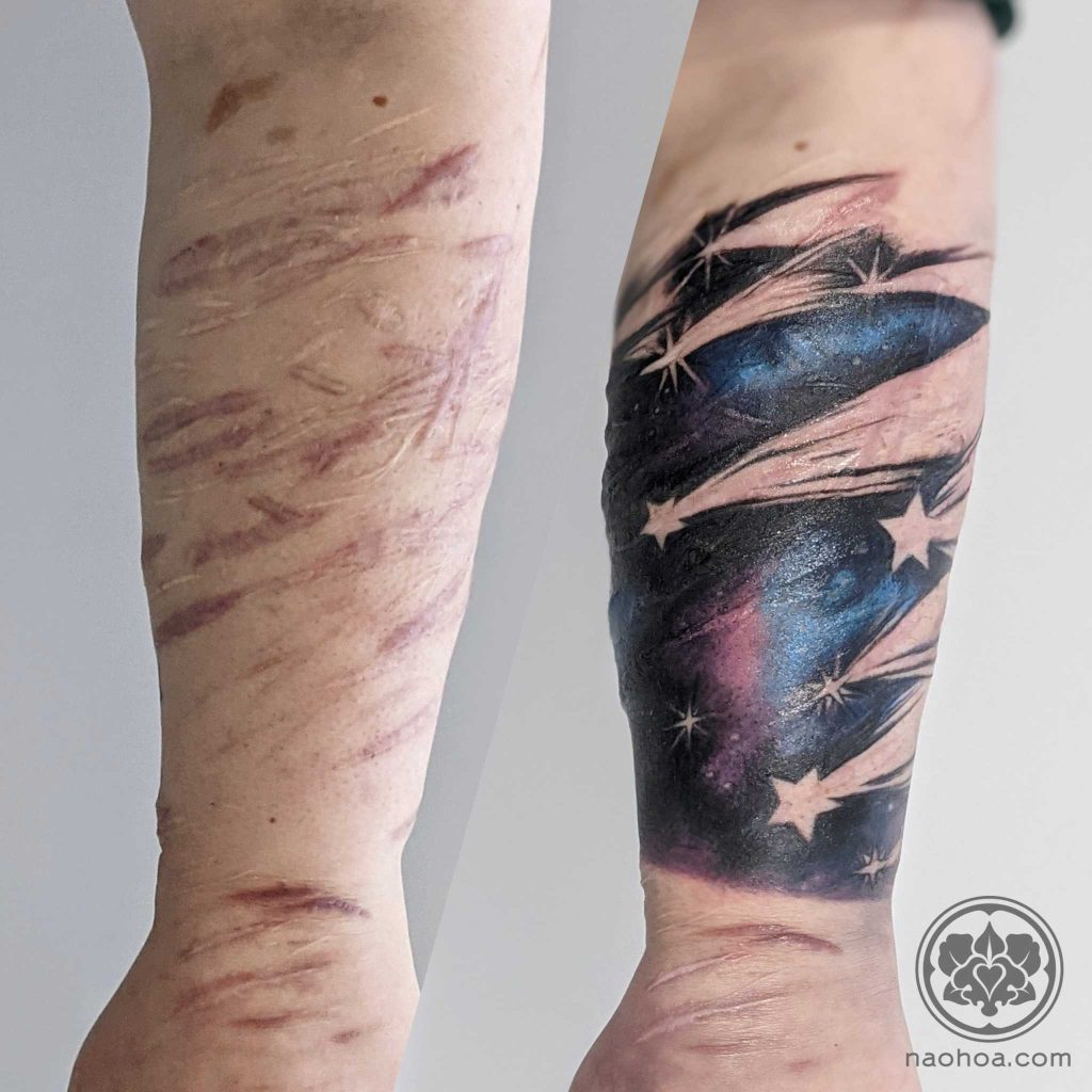 27 Top Self Harm Scar Tattoo Cover Up Ideas 2024 Tattoo Ideas   Tattooing Over Scars Naohoa 1024x1024 